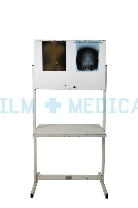 X Ray Lightbox Freestanding Double (x rays priced separately)
